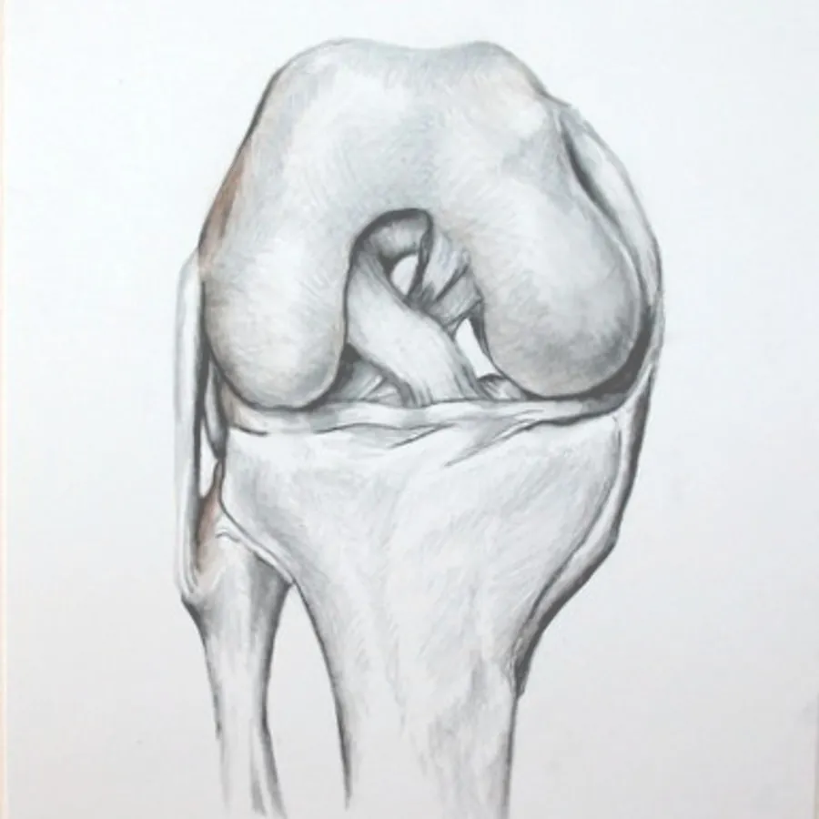 Hand-drawn anatomy illustration — knee surgery